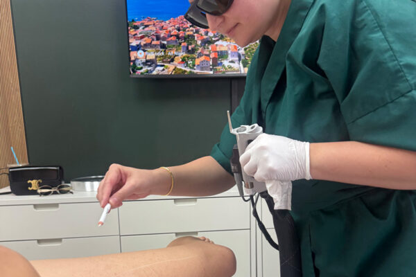 Laser hair removal for women