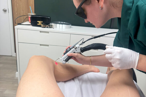 Laser hair removal for men